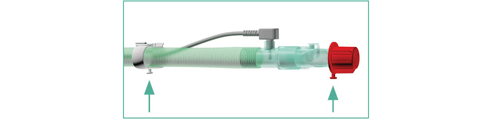 tube management banner